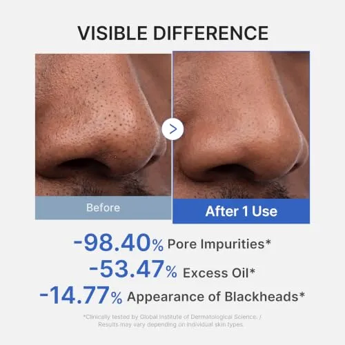ZERO PORE BLACKHEAD MUD MASK 100g — foto 4 de 8
